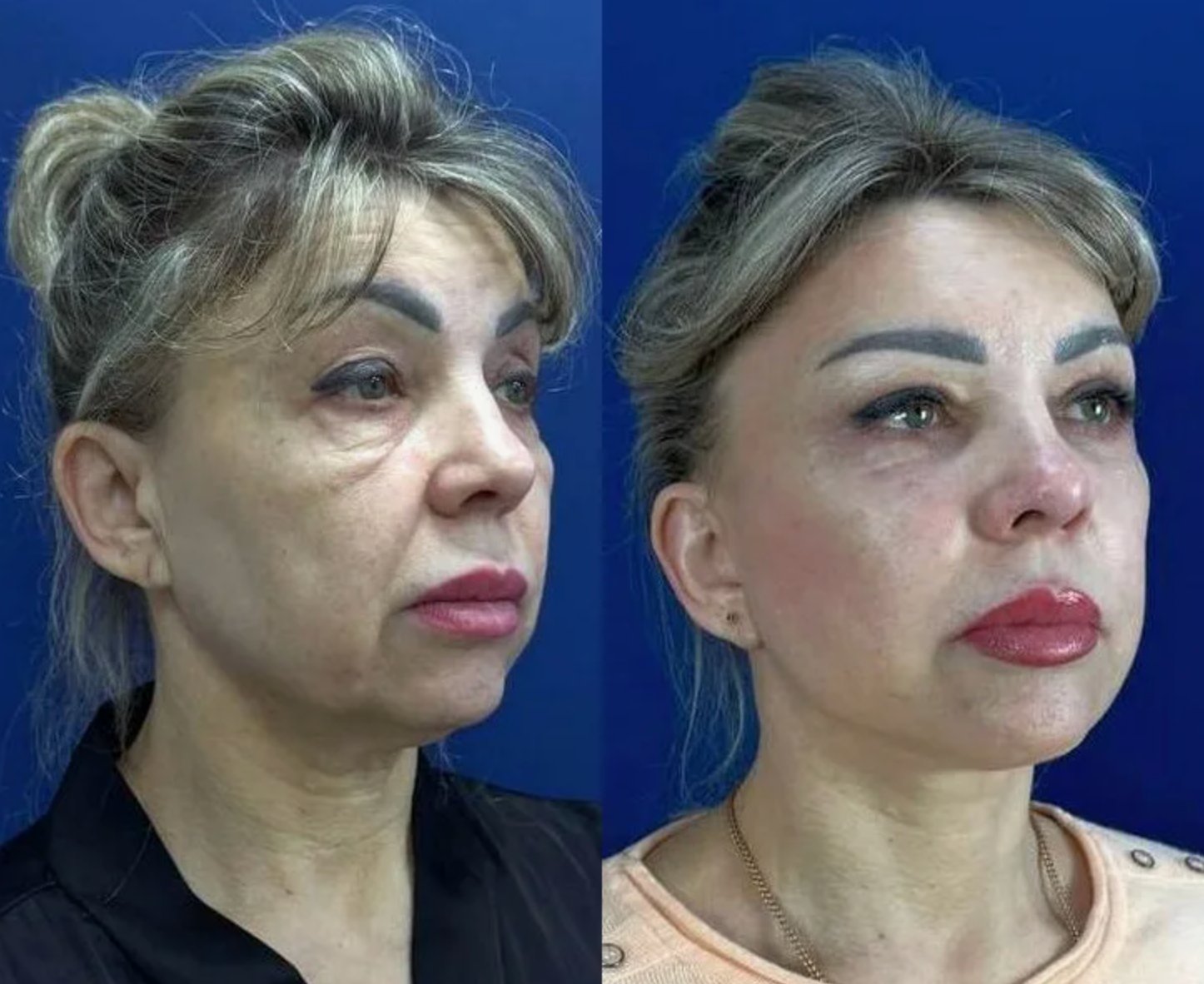 До и после — результат 2