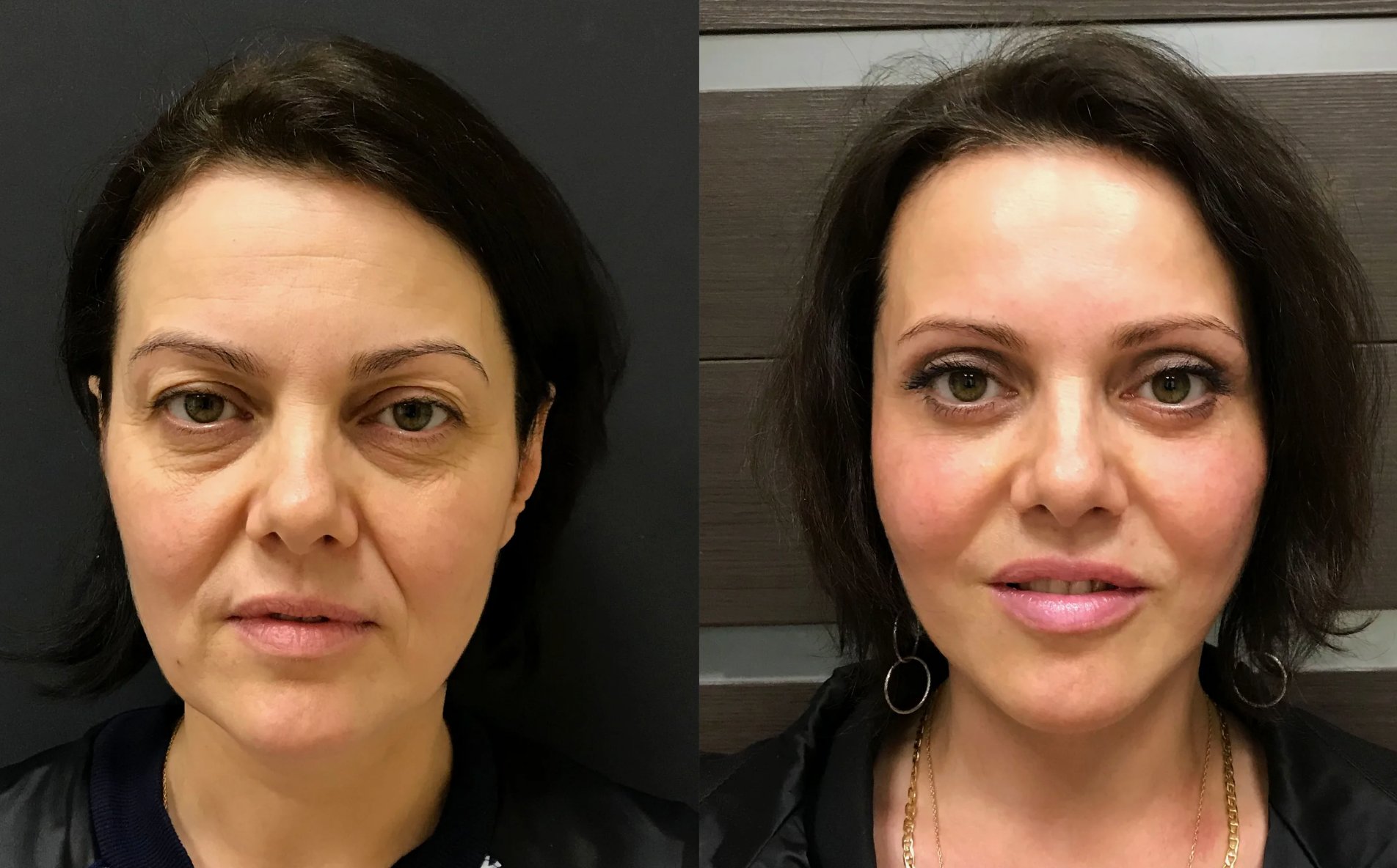 До и после 5